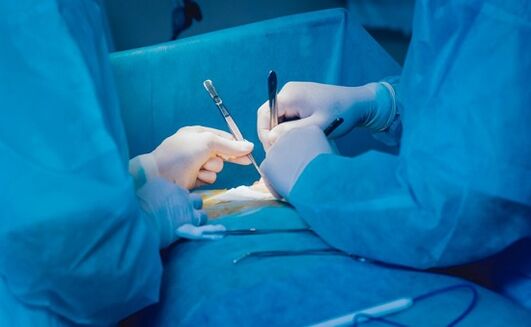 realizando cirurgia de aumento do pênis