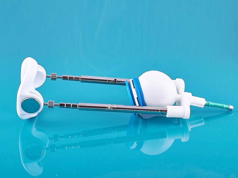 Extensor – um dispositivo para aumentar o comprimento do pênis